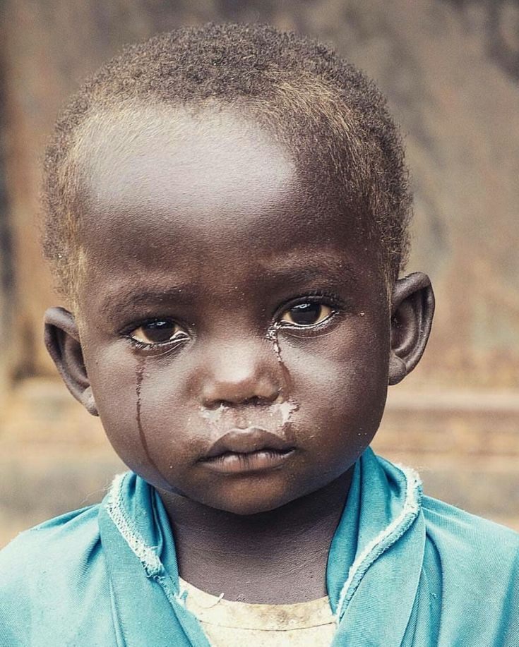A young Ghanaian child with tear-streaked cheeks looking forward